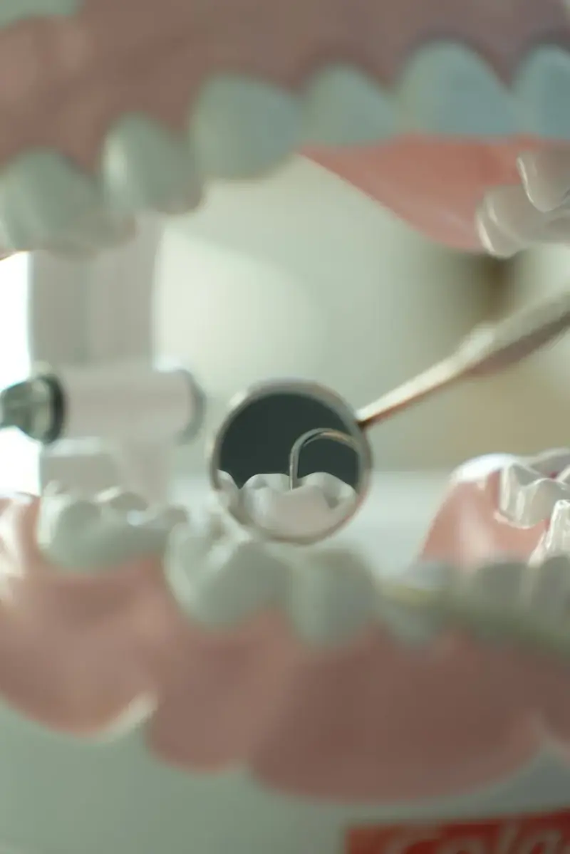 Dental Fillings